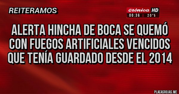 Placas Rojas - Alerta hincha de boca se quemó con fuegos artificiales vencidos que tenía guardado desde el 2014 Placas Rojas - Alerta hincha de boca se quemó con fuegos artificiales vencidos que tenía guardado desde el 2014