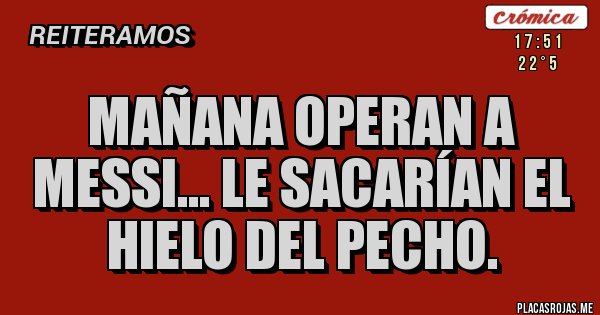 Placas Rojas - Mañana operan a Messi... Le sacarían el hielo del pecho. Placas Rojas - Mañana operan a Messi... Le sacarían el hielo del pecho.